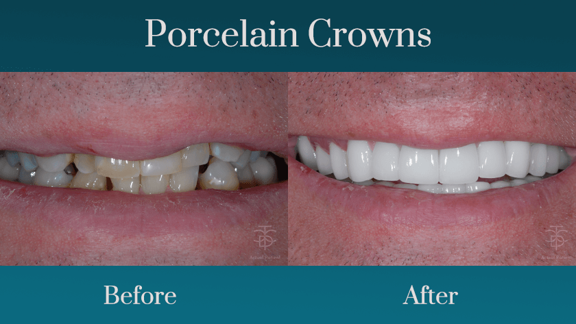 cosmetic dentistry procedures